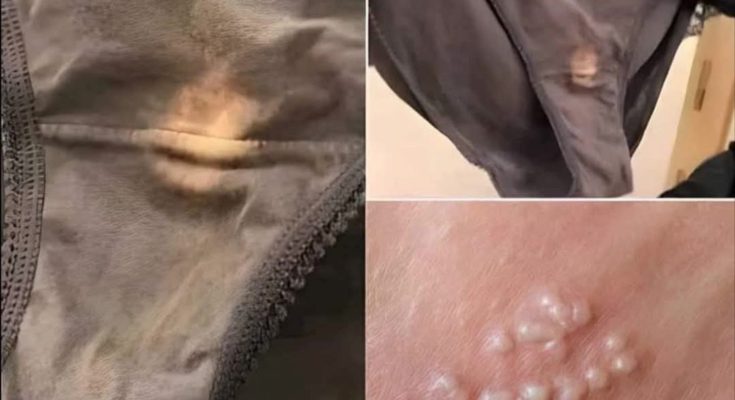 BE CAREFUL , If you spot these dots on your skin, it means you have Can…See more