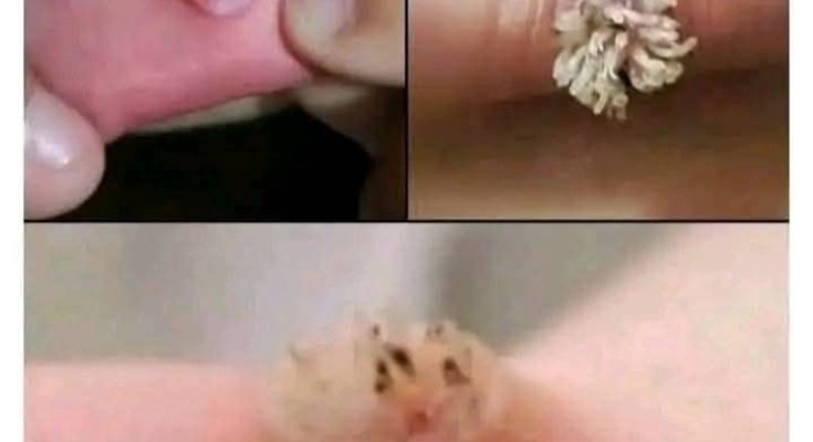 BE VERY CAREFUL . If you get this, you are infected with …. See more