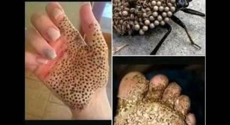 If you see one of these in your home  , don’t touch it, just run for…Read More